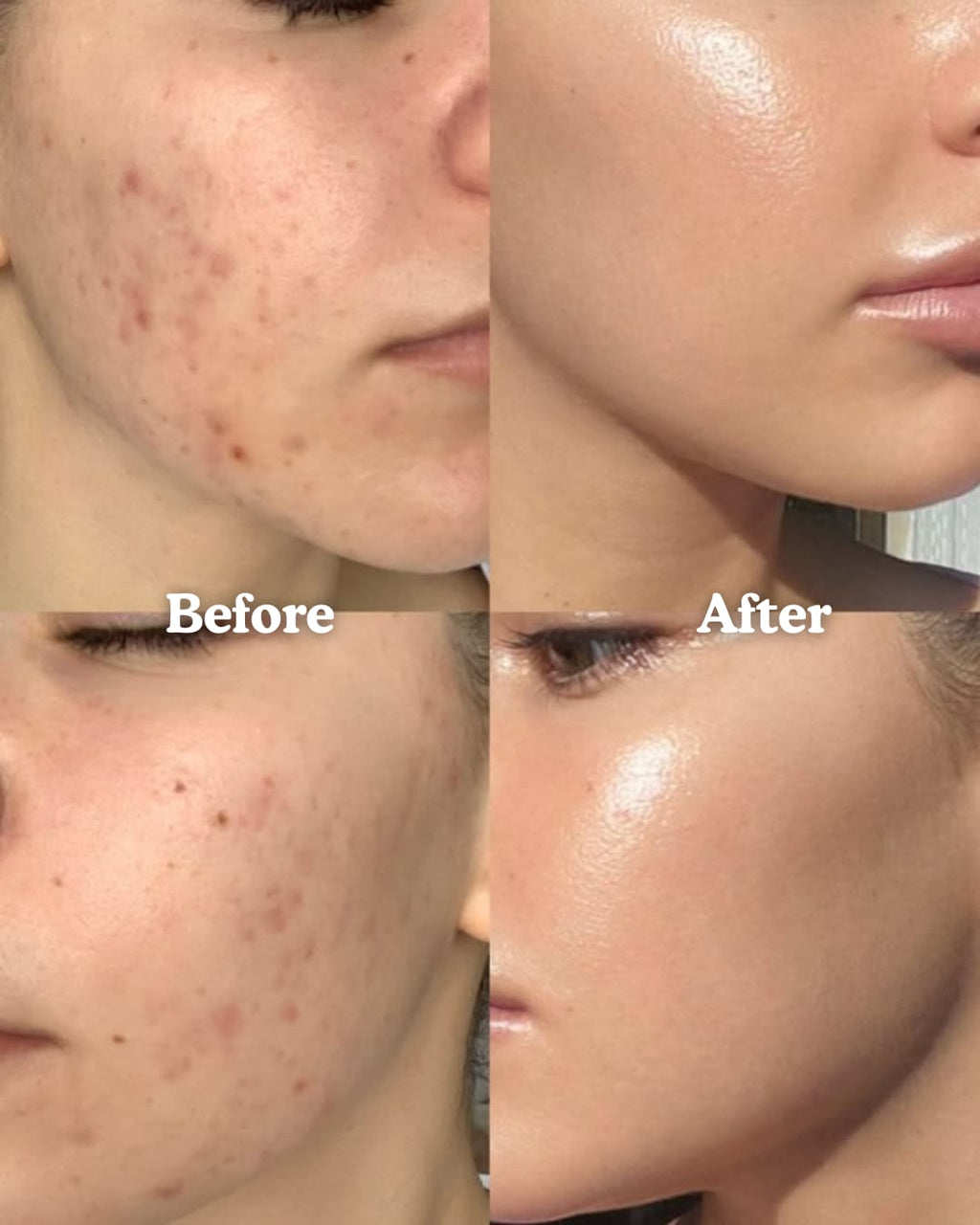 Lymphatic Contour Face Brush - Facial Massager for Jawline, Chin & Neck