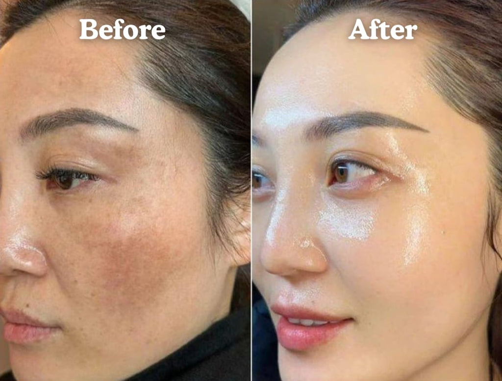 Lymphatic Contour Face Brush - Facial Massager for Jawline, Chin & Neck